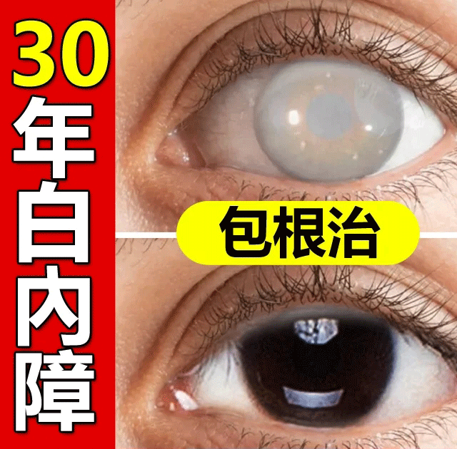 【日本最新白內障滴眼液】治療：近視/遠視/散光/老花眼/乾眼/青光眼/白內障/眼疲勞/角膜炎症/黃斑變性/翼狀胬肉等眼部疾病 無需手術，治療你的眼疾。健康的眼睛，讓世界更明亮