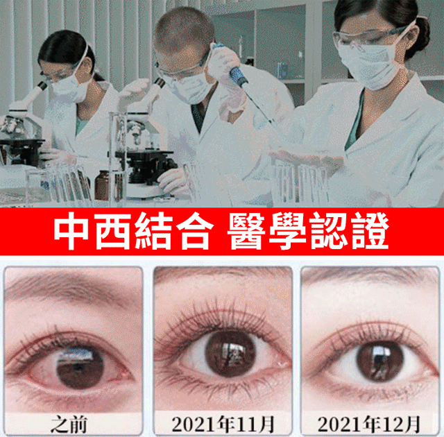 【日本最新白內障滴眼液】治療：近視/遠視/散光/老花眼/乾眼/青光眼/白內障/眼疲勞/角膜炎症/黃斑變性/翼狀胬肉等眼部疾病 無需手術，治療你的眼疾。健康的眼睛，讓世界更明亮